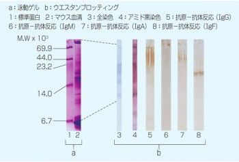 Transfer Protein/Hybridization Membrane Filter